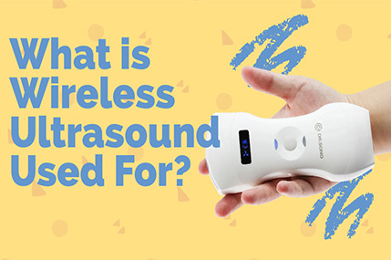 What is Wireless Ultrasound Used For