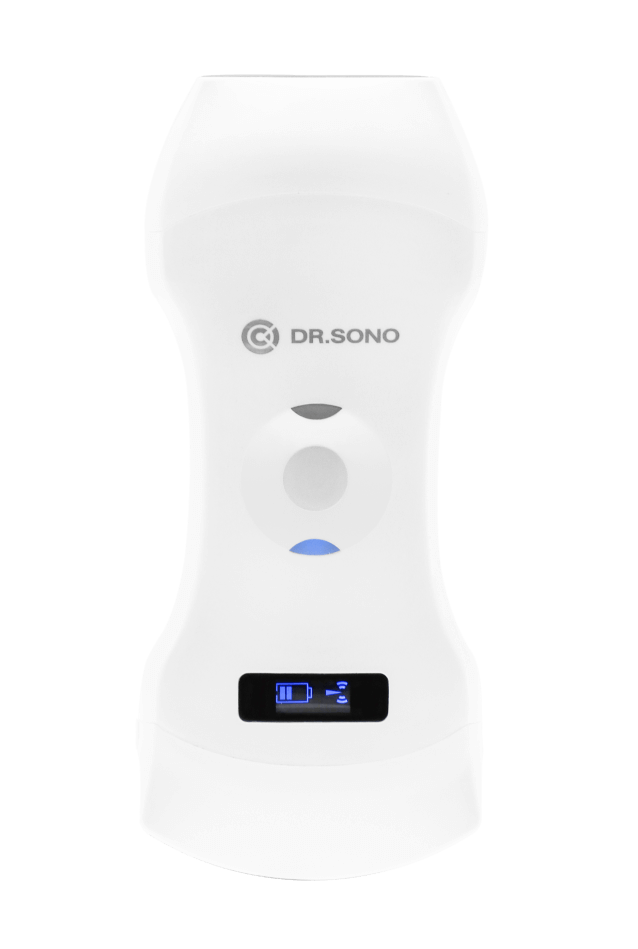 DRSONO portable ultrasound high quality Image