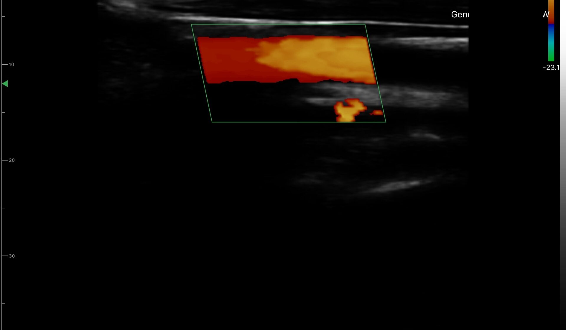 DRSONO portable ultrasound scanner 192E HD images 10