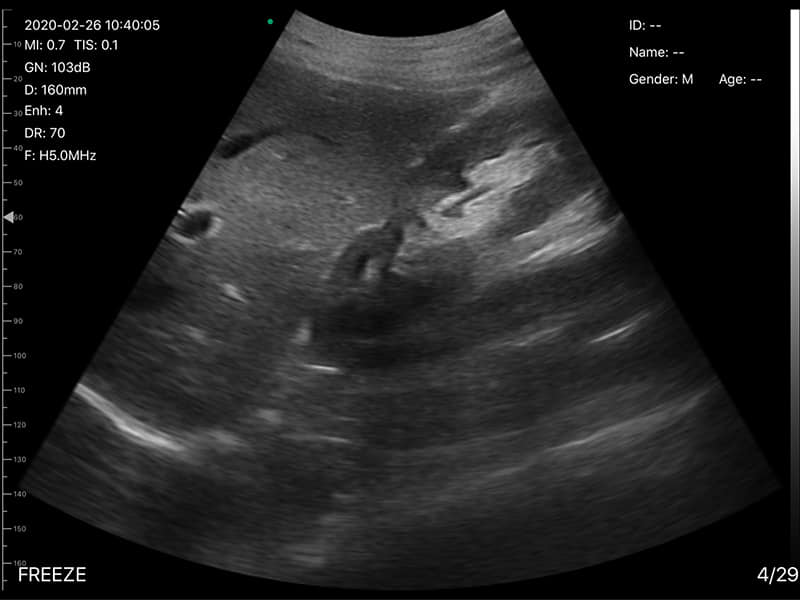 DRSONO portable ultrasound scanner 192E HD images 2