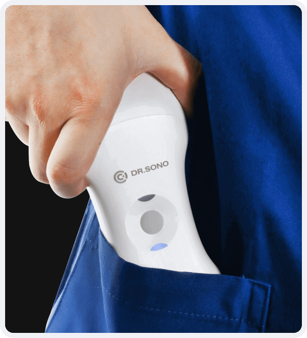 Wireless ultrasound scanner scan anywhere and anytime