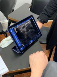 pocket ultrasound DOROTHY's review