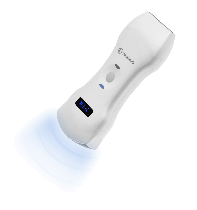 portable ultrasound scanner avaiable 15 Specialties