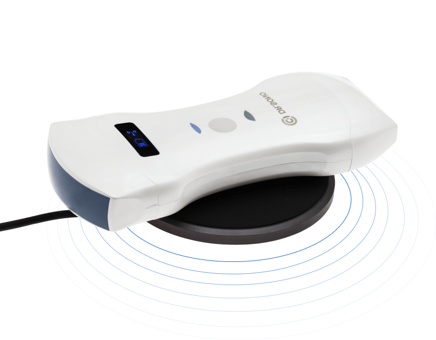 portable ultrasound scanner continues 5 hours scanning