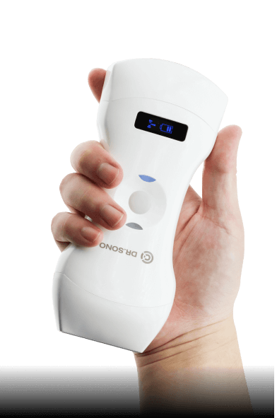 portable ultrasound scanner image