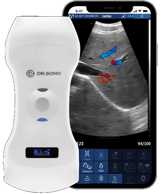 DRSONO 3 in 1 Portable Ultrasound Scanner