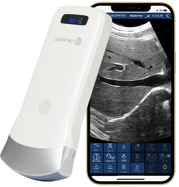 DRSONO Convex Ultrasound Scanner HD Image -