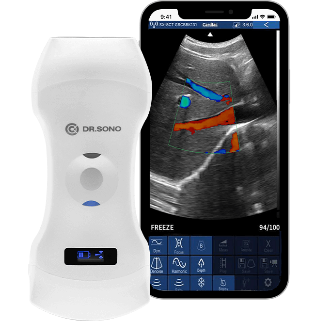 DRSONO Portable Ultrasound Scanner Banner Image
