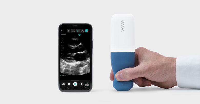 Vave wireless ultrasound