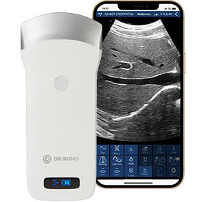 Convex ultrasound scanner