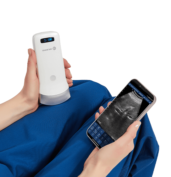 DRSONO Portable Ultrasound Scanner Fast-Charging