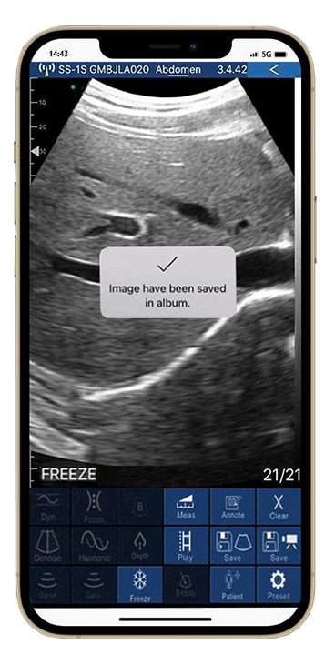 DRSONO Portable Ultrasound Scanner Instantly Preserve Scan Images