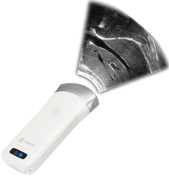 DRSONO Portable Ultrasound Scanner SPEC Image