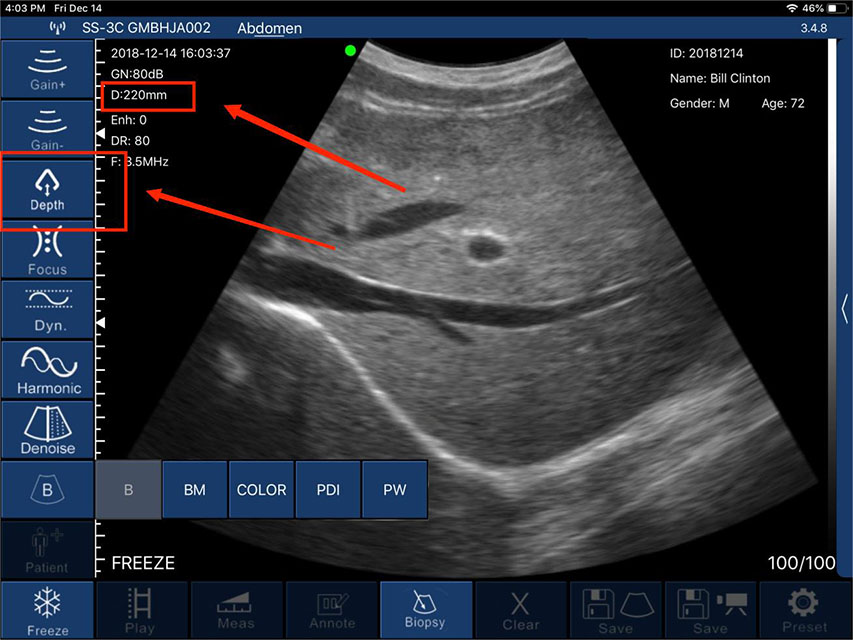 Depth (D)-DRSONO Portable ultrasound scanner App