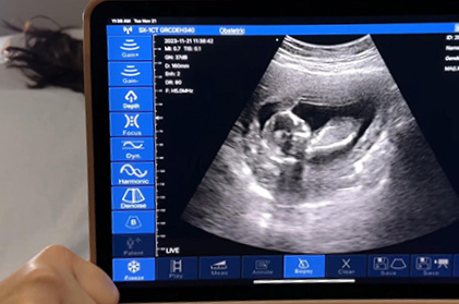 How to Read an Ultrasound: Text, Images, and Colors
