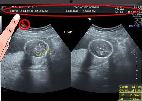How to Read an Ultrasound
