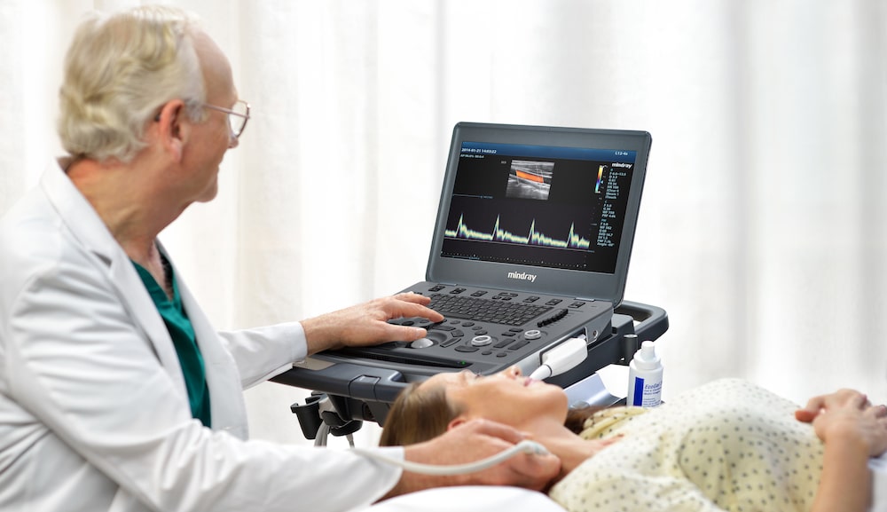 Influence the Prices of Ultrasound Machines