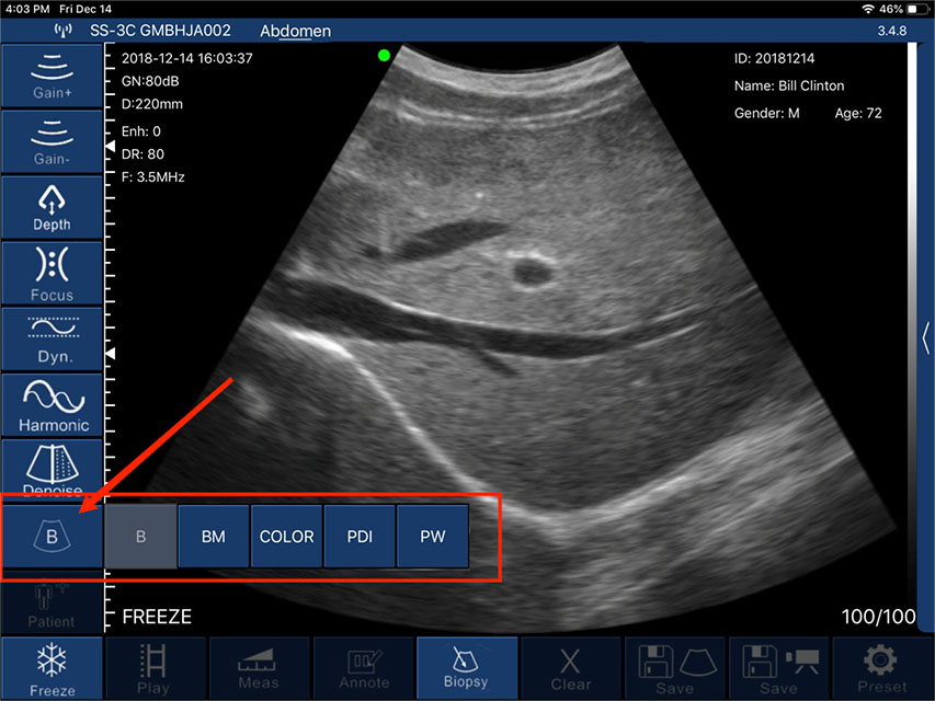 Modes-DRSONO Portable Ultrasound Scanner