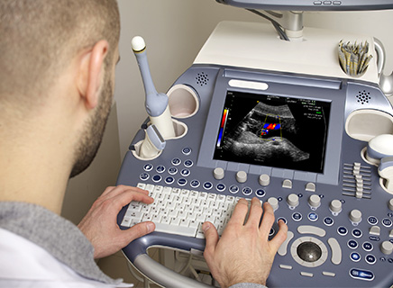Shared service ultrasound machines-Ultrasound Machine cost
