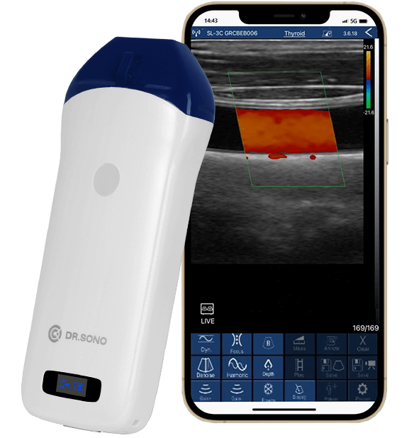 DRSONO Portable Linear probe ultrasound scanner banner image