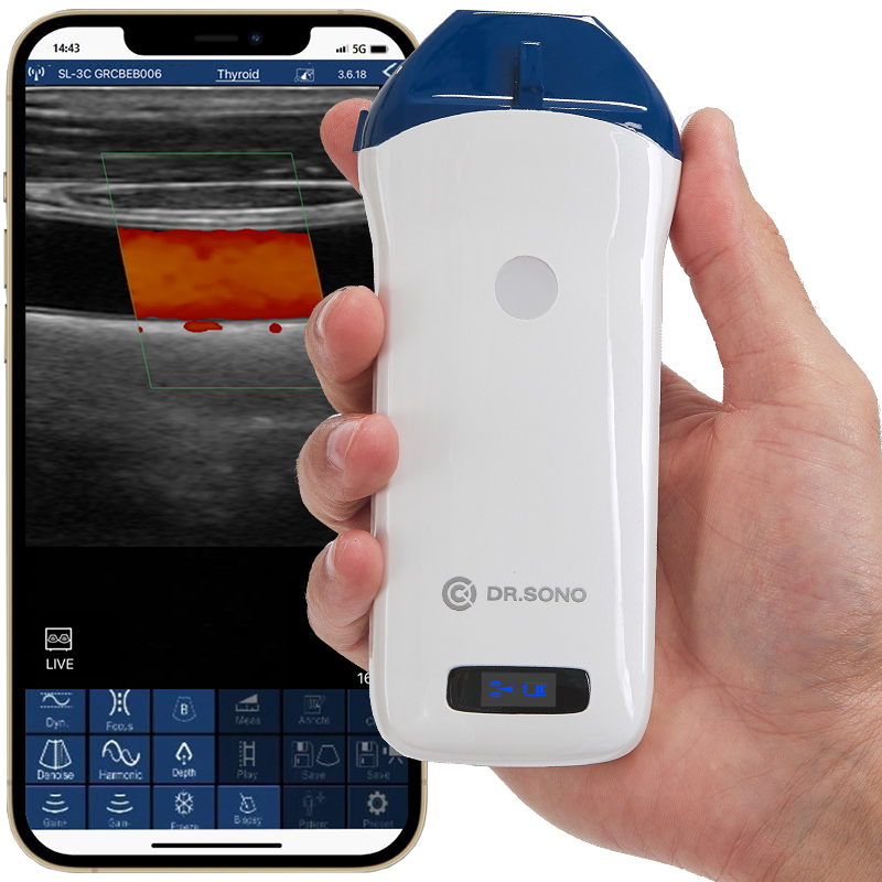 DRSONO wireless pocus ultrasound scanner