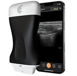 Linear-Handheld-Portable-Wireless-Ultrasound-Scanner