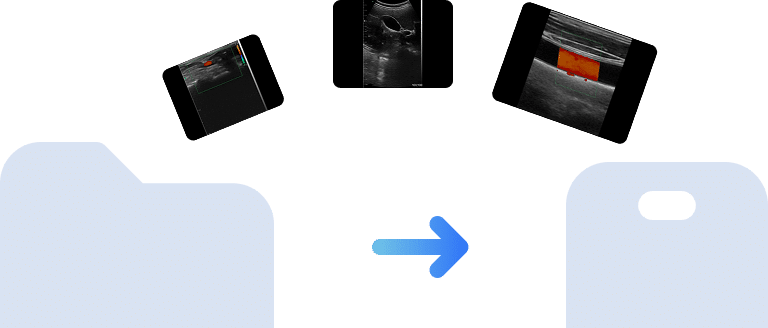 DRSONO Free App Portable Ultraschallgerät Bildanteil