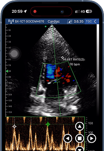 DRSONO Handheld-Ultraschallgerät