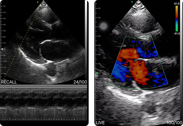 DRSONO Handheld-Ultraschallgerät Herz