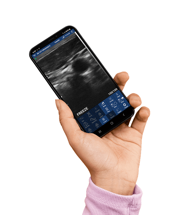 DRSONO Handheld-Ultraschallgerät für die Tasche