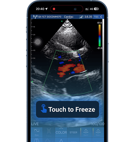 DRSONO Handheld-Ultraschallgerät