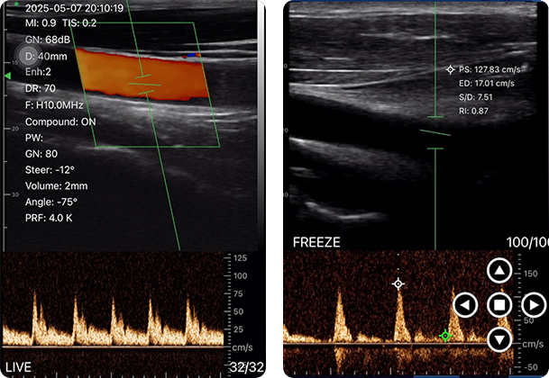 DRSONO Taschen-Ultraschallgerät vaskulär