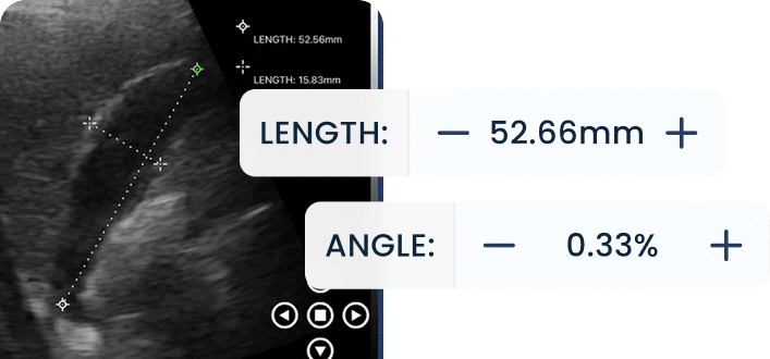 DRSONO Tragbares Ultraschallgerät Best