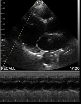 DRSONO Tragbares Ultraschallgerät M-Modus