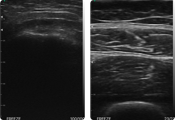 DRSONO Tragbares Ultraschallgerät MSK