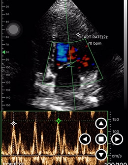 DRSONO Tragbares Ultraschallgerät PW-Modus