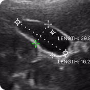 DRSONO Tragbares Ultraschallgerät Scanner Kostenlose App