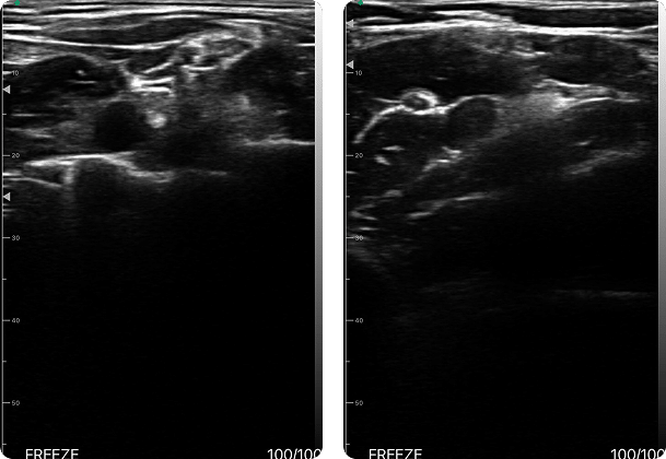 DRSONO Tragbares Ultraschallgerät Nerv
