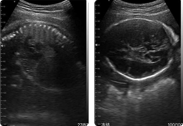 DRSONO Tragbarer Ultraschallscanner für die Geburtshilfe