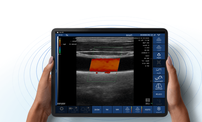 DRSONO Ecógrafo portátil SPEC