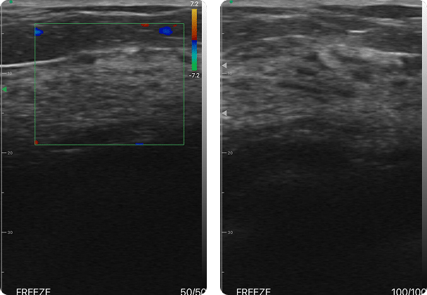 DRSONO Handheld-Ultraschallgerät Brust