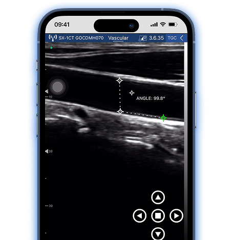 DRSONO persönliches Ultraschallgerät