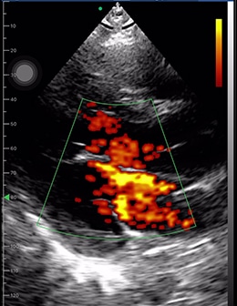 drsono handhele ultraosund