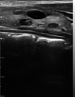 Schilddrüse-DRSONO Tragbares Ultraschallgerät B-Modus