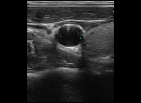Point of Care Ultrasound Clinical gallery Clinical gallery