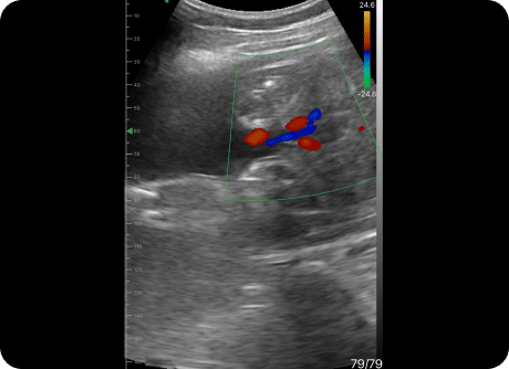 Handheld Ultrasound Clinical gallery