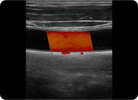 Point of Care Ultrasound Clinical gallery