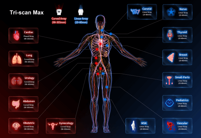 drsono Hand-Ultraschallgerät
