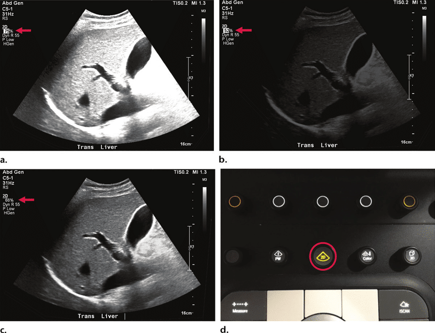 Figura-Overall-gain-setting-amplifies-all-ultrasound-signals-by-a-constant-factor