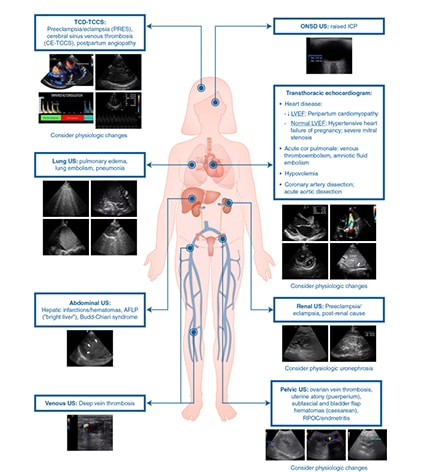 Ultraschall zur Diagnose
